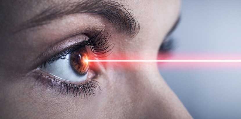 Ein Laserstrahl der auf die Hornhaut eines Auges trifft.
