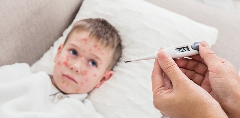 Junge mit Masern-Infektion ist nach Kontakt mit dem Erreger krank und ansteckend.